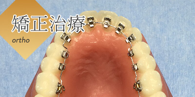 矯正治療