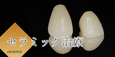 セラミック治療